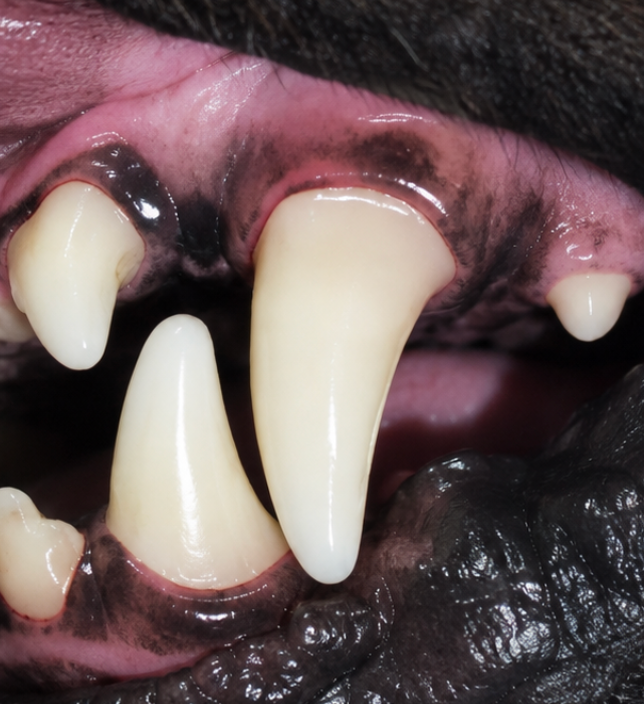 After dental cleaning — Dental Cleaning — Pair 1